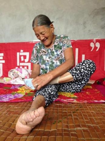 Par ķīniešu skaistuma upuri, kuriem ir pārsteidzoši mazas kājas. / Foto: interesnoznat.com. 